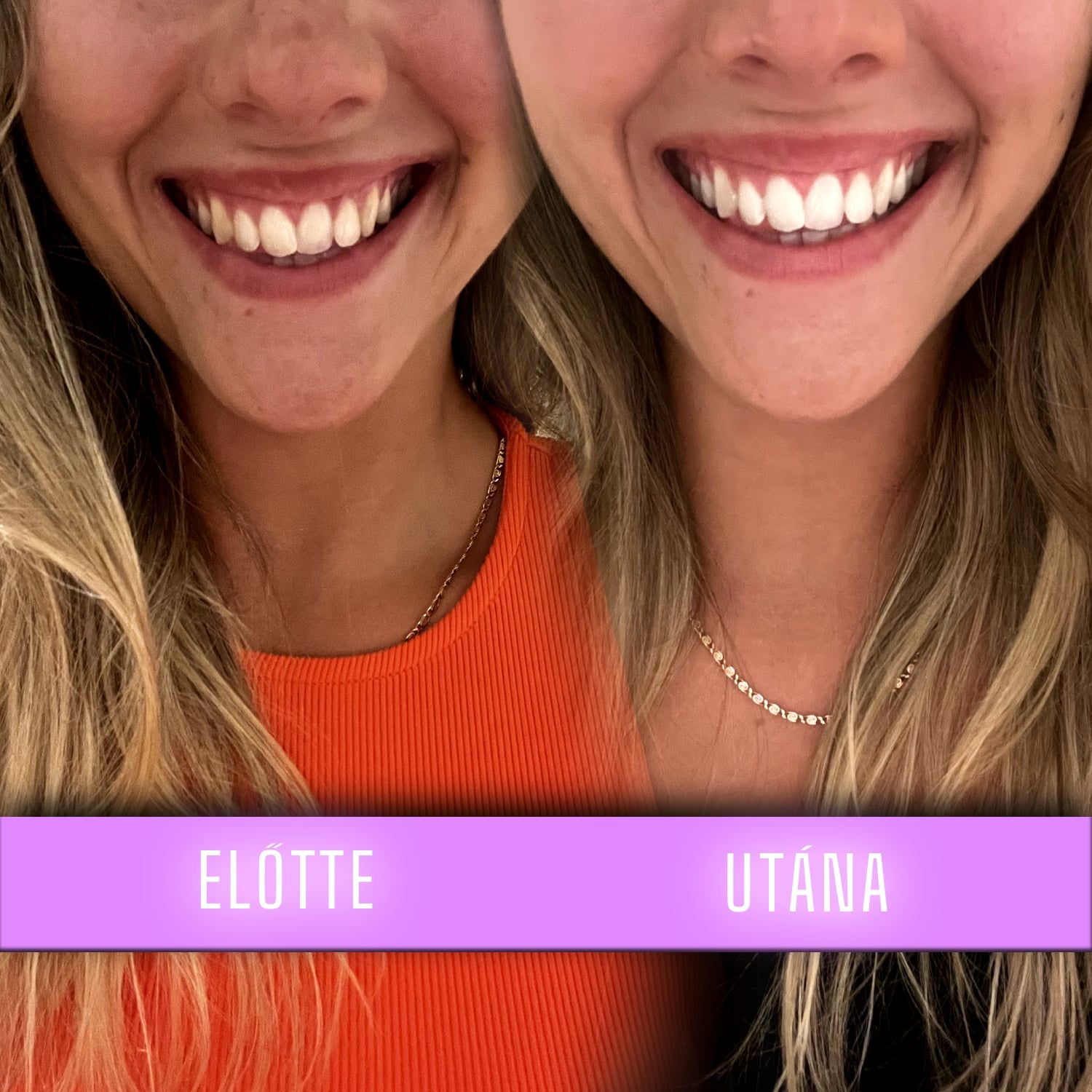 before_after--1